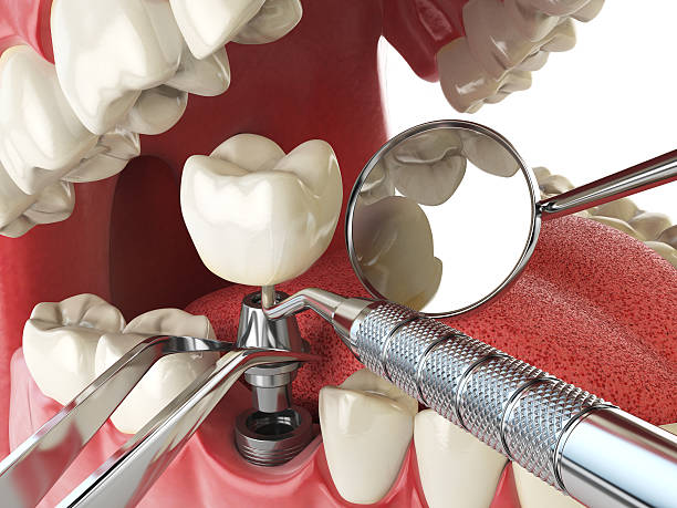 , MT Emergency Dentist Company